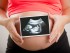 Saignements et fausse-couche chez la femme enceinte